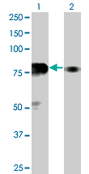 SP100 monoclonal antibody (M02), clone 1G6