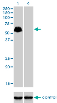 SP100 monoclonal antibody (M02), clone 1G6