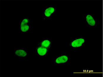 SOX9 monoclonal antibody (M04), clone 3F11