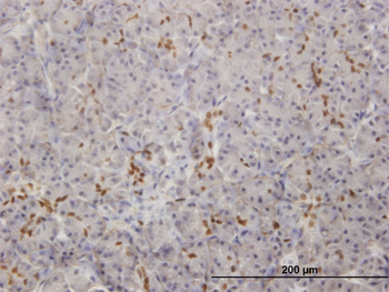 SOX9 monoclonal antibody (M04), clone 3F11