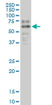 SOX9 monoclonal antibody (M04), clone 3F11