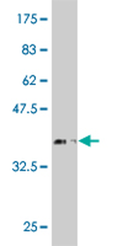 SOX9 monoclonal antibody (M04), clone 3F11