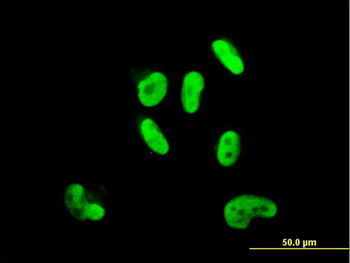 SOX9 monoclonal antibody (M02), clone 3C10