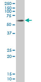 SOX9 monoclonal antibody (M02), clone 3C10