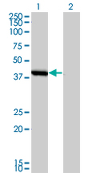 SMS monoclonal antibody (M01), clone 1G6