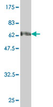 SMPD2 monoclonal antibody (M01), clone 2C9