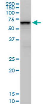 SMARCD2 monoclonal antibody (M02), clone 2B2