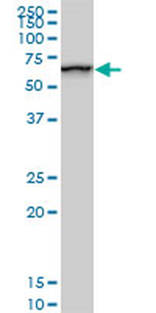 SMARCD2 monoclonal antibody (M02), clone 2B2