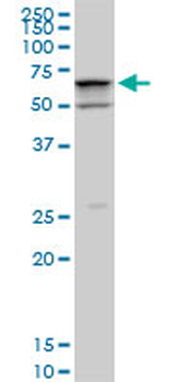 SMARCD2 monoclonal antibody (M02), clone 2B2