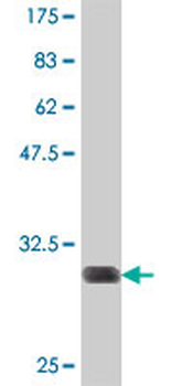 SLCO2A1 polyclonal antibody (A01)