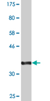 SLC20A2 monoclonal antibody (M04), clone 4B1