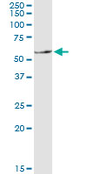SLC11A1 monoclonal antibody (M01), clone 2G2