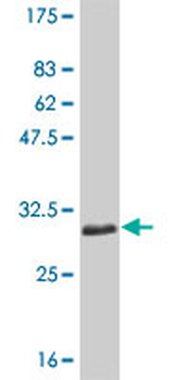 SLC11A1 monoclonal antibody (M01), clone 2G2