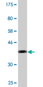 SLC5A3 monoclonal antibody (M02), clone 3A6