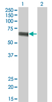 SLC5A2 monoclonal antibody (M01), clone 3G8