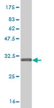 SLC5A2 monoclonal antibody (M01), clone 3G8