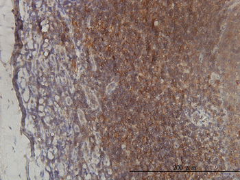 ST3GAL2 monoclonal antibody (M01), clone 1E12