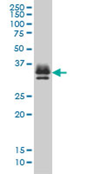 ST3GAL2 monoclonal antibody (M01), clone 1E12