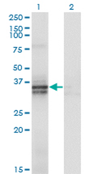 ST3GAL2 monoclonal antibody (M01), clone 1E12