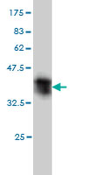 ST3GAL2 monoclonal antibody (M01), clone 1E12
