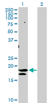 ST6GAL1 purified MaxPab rabbit polyclonal antibody (D01P)