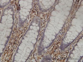 SHMT1 monoclonal antibody (M01), clone 4F9