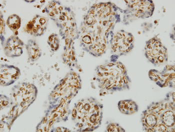 SHMT1 monoclonal antibody (M01), clone 4F9