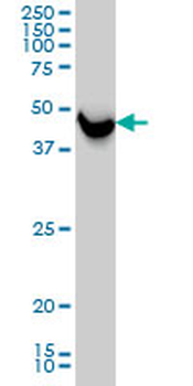 SHMT1 monoclonal antibody (M01), clone 4F9