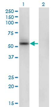 SHMT1 monoclonal antibody (M01), clone 4F9