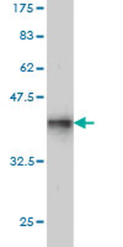 SHMT1 monoclonal antibody (M01), clone 4F9