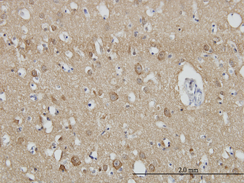 SH3GL2 monoclonal antibody (M01), clone 5A6