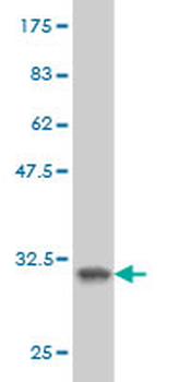 SH3GL2 monoclonal antibody (M01), clone 5A6