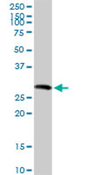 SGCG MaxPab rabbit polyclonal antibody (D01)