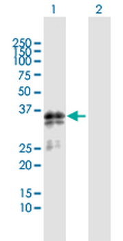 SGCG MaxPab rabbit polyclonal antibody (D01)