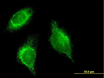 SFTPD monoclonal antibody (M03), clone 2C10