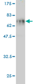 SFTPD monoclonal antibody (M03), clone 2C10