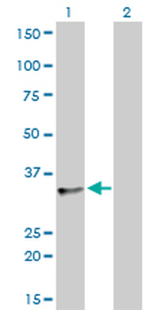 SFRS10 monoclonal antibody (M01), clone 7A1