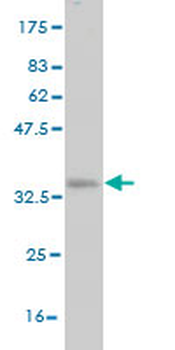SFRS10 monoclonal antibody (M01), clone 7A1