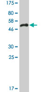 SFRS5 monoclonal antibody (M03A), clone 2C8