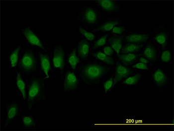 SFRS3 monoclonal antibody (M08), clone 2D2