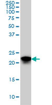 SFRS3 monoclonal antibody (M08), clone 2D2