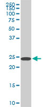 SFRS3 monoclonal antibody (M08), clone 2D2