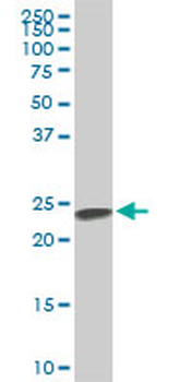 SFRS3 monoclonal antibody (M08), clone 2D2