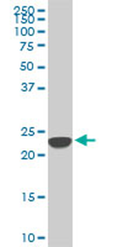 SFRS3 monoclonal antibody (M08), clone 2D2
