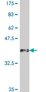 SFRP4 polyclonal antibody (A01)