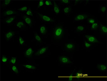 SFPQ monoclonal antibody (M02), clone 6D7