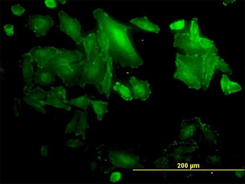 SDCBP monoclonal antibody (M01), clone 2C12