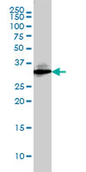 SDCBP monoclonal antibody (M01), clone 2C12