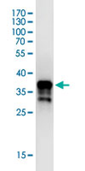 SDCBP monoclonal antibody (M01), clone 2C12