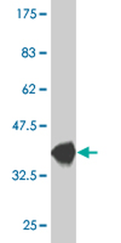 CXCL5 monoclonal antibody (M05), clone 2A9